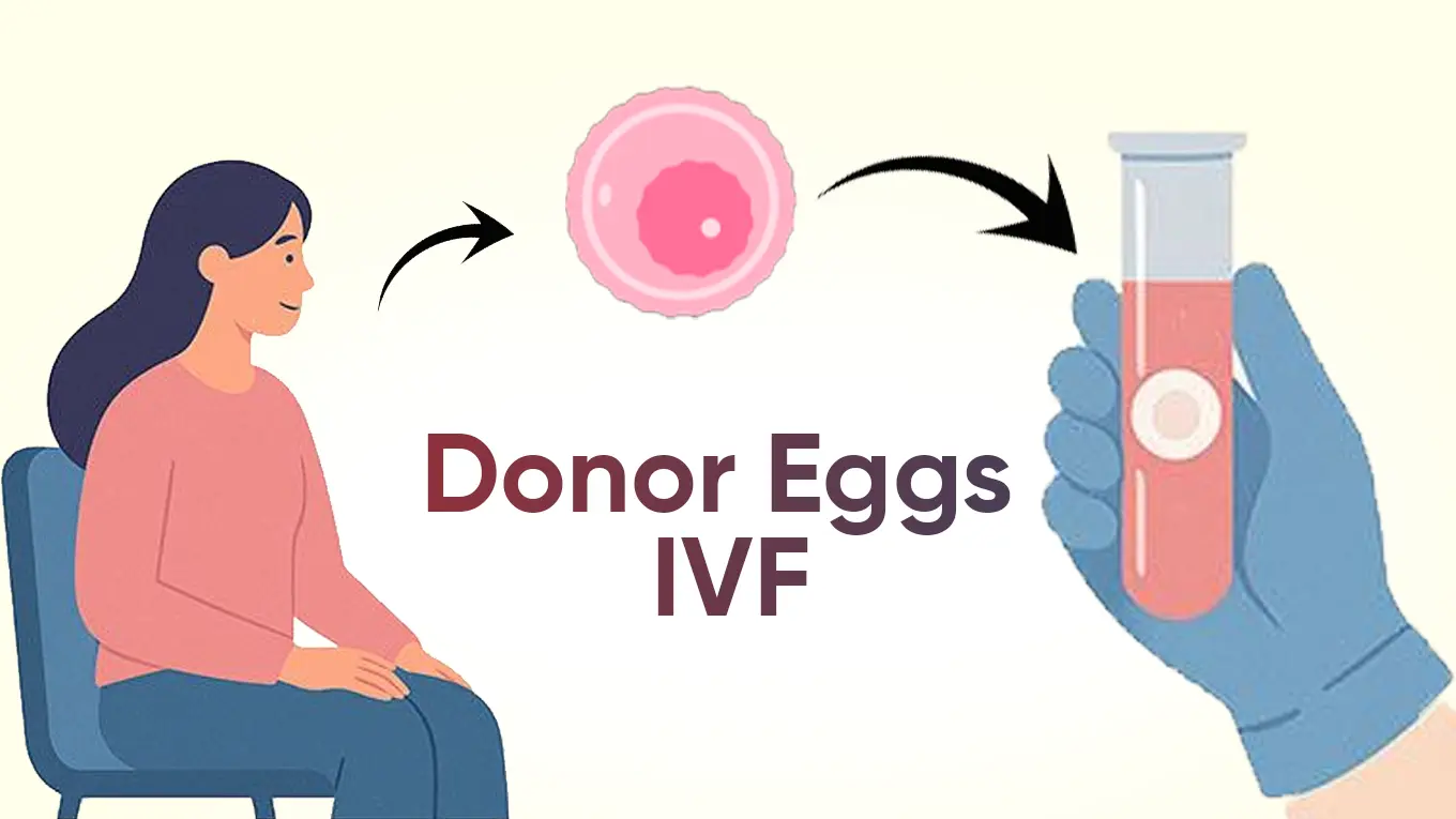 Donor Eggs IVF Treatment Patna