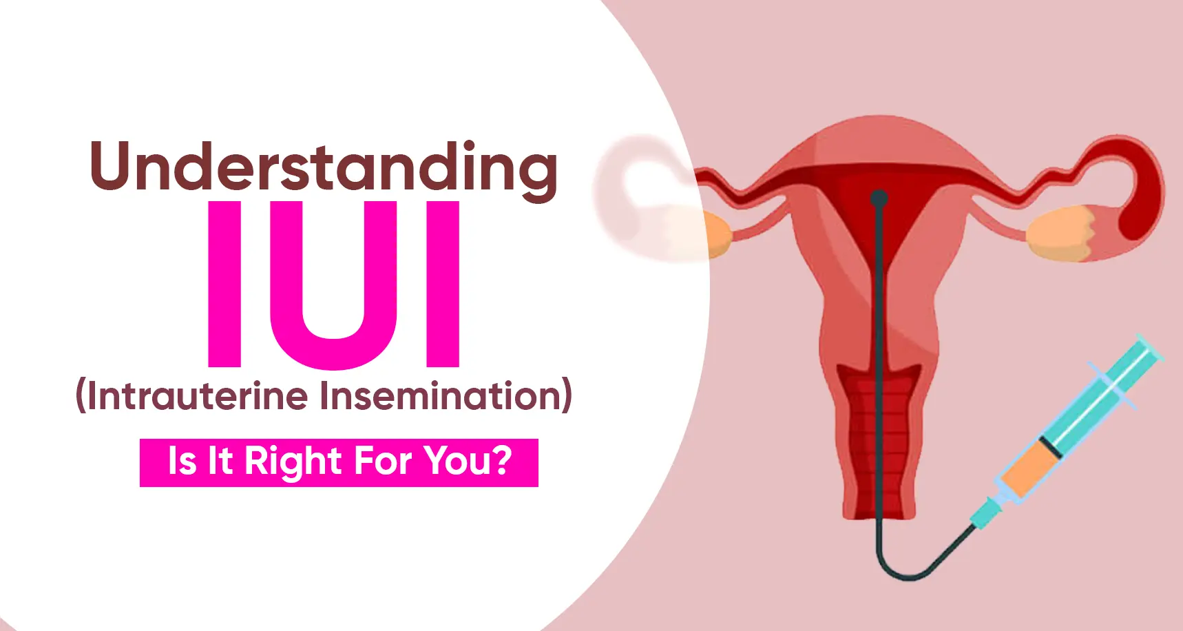 IUI treatment process timing and success factors in Patna